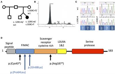 Classical and Non-classical Presentations of Complement Factor I Deficiency: Two Contrasting Cases Diagnosed via Genetic and Genomic Methods